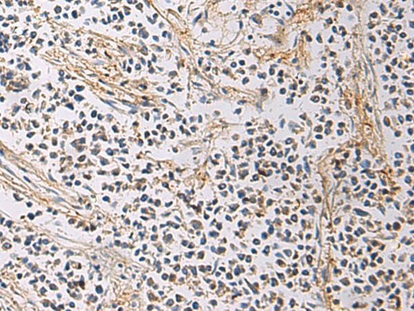 GMPR Polyclonal Antibody (E-AB-19242)