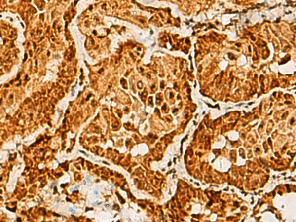 SAP30BP Polyclonal Antibody (E-AB-19221)
