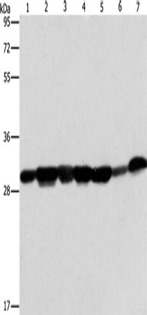 AK2 Polyclonal Antibody (E-AB-10926)