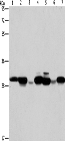 AK2 Polyclonal Antibody (E-AB-14703)