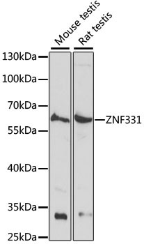ZNF331 Polyclonal Antibody (E-AB-65330)