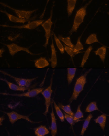 STAR Polyclonal Antibody (E-AB-66818)