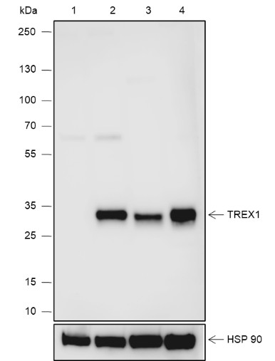 Recombinant TREX1 Monoclonal Antibody (AN301927L)
