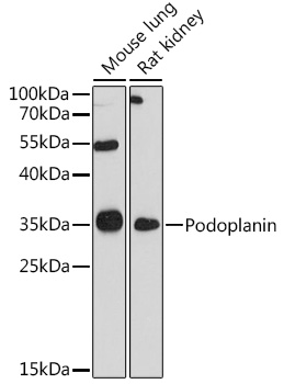Podoplanin Polyclonal Antibody (E-AB-90627)