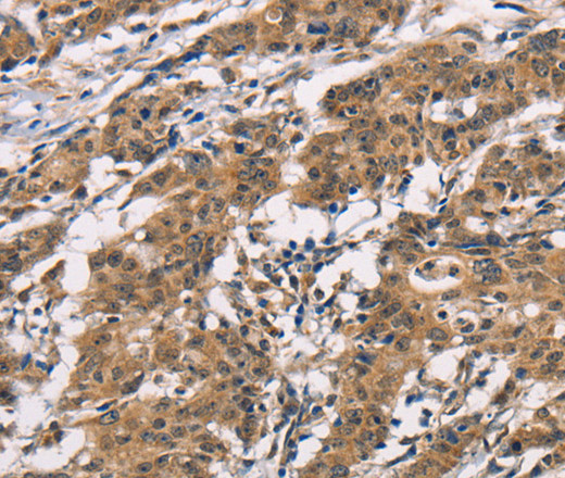 ADGRB1 Polyclonal Antibody (E-AB-13084)