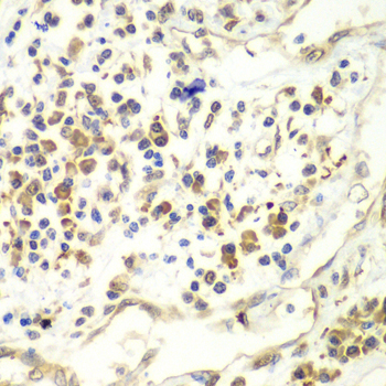 UPF1 Polyclonal Antibody (E-AB-64702)
