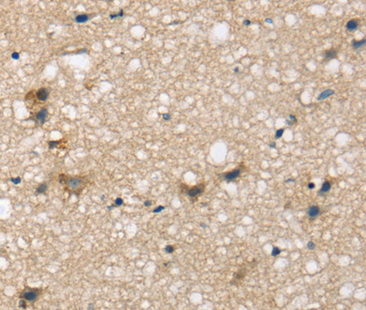 SEMA4A Polyclonal Antibody (E-AB-15382)