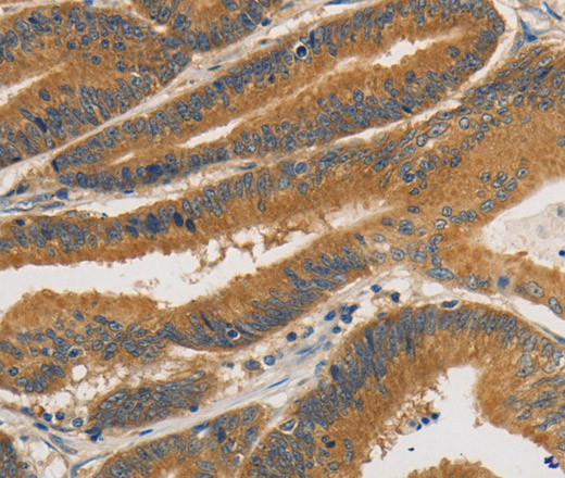 PRKD1 Polyclonal Antibody (E-AB-12843)