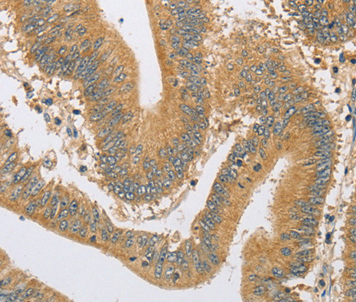 ARHGEF1 Polyclonal Antibody (E-AB-14608)
