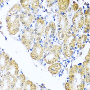 BNIP3L Polyclonal Antibody (E-AB-61182)