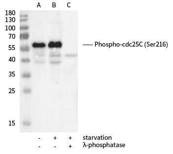 Recombinant Phospho-cdc25C (Ser216) Monoclonal Antibody (AN300220L)