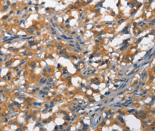 DDR2 Polyclonal Antibody (E-AB-12775)