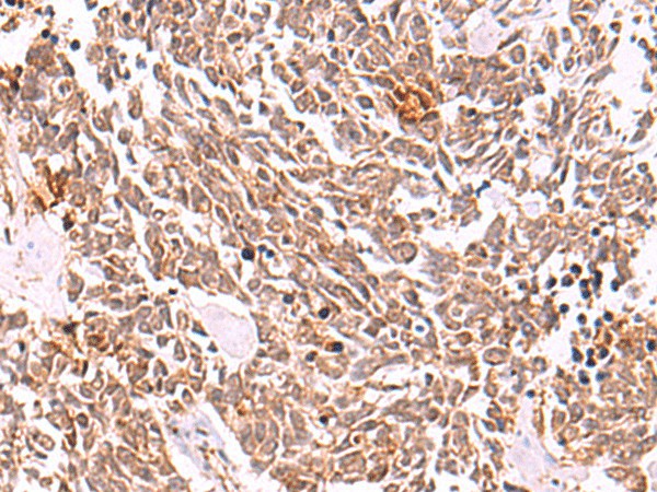 COPS3 Polyclonal Antibody (E-AB-52946)