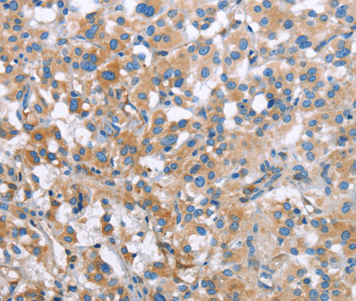 MCL1 Polyclonal Antibody (E-AB-13072)