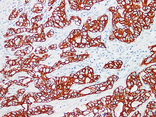 CK7 Monoclonal Antibody (ELAB6628-M)