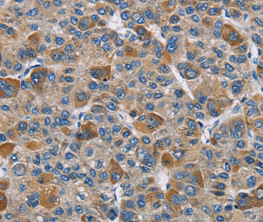 DNMT3A Polyclonal Antibody (E-AB-10846)