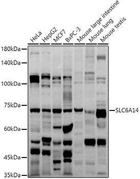 SLC6A14 Polyclonal Antibody (E-AB-90215)