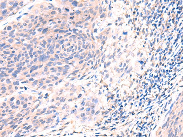 ESM1 Polyclonal Antibody (E-AB-18262)