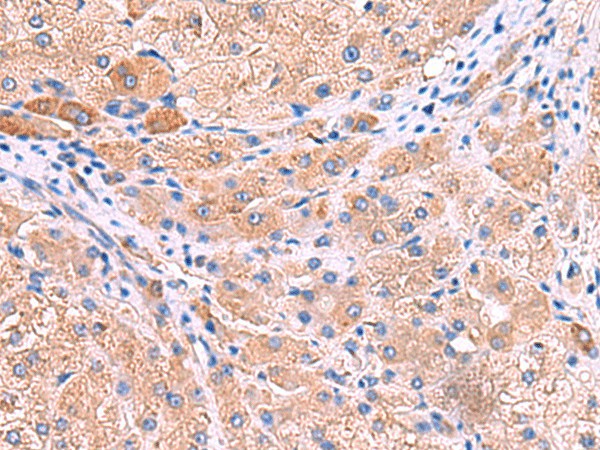 MPP1 Polyclonal Antibody (E-AB-52967)