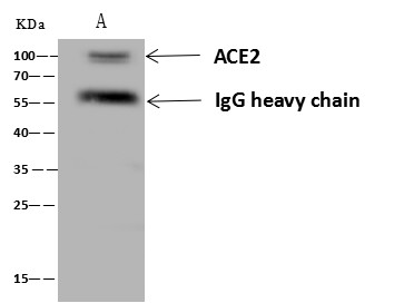 Recombinant ACE2 Monoclonal Antibody (AN300026P)