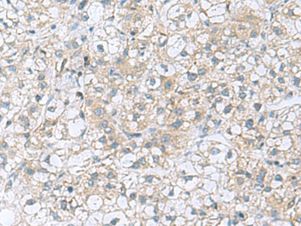 TRO Polyclonal Antibody (E-AB-53006)