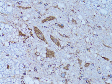HADH Polyclonal Antibody (E-AB-60172)