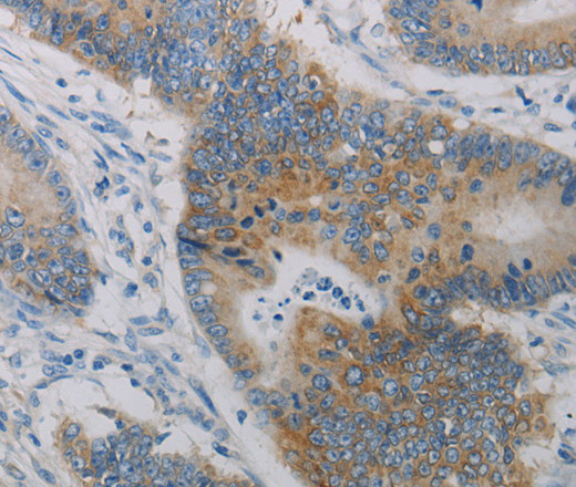 CD303 Polyclonal Antibody (E-AB-12821)