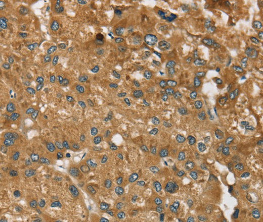 RPS6KA2 Polyclonal Antibody (E-AB-16773)