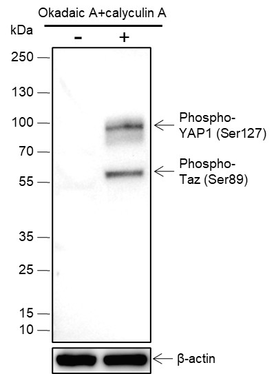 Recombinant Phospho-YAP1 (Ser127) Monoclonal Antibody (AN302080L)