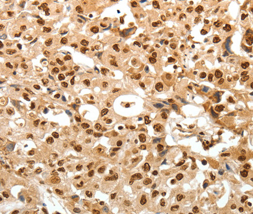 TNXB Polyclonal Antibody (E-AB-16089)