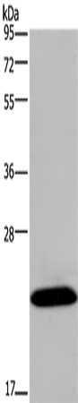 KCNMB4 Polyclonal Antibody (E-AB-13358)