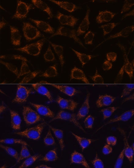 GTPBP8 Polyclonal Antibody (E-AB-66717)