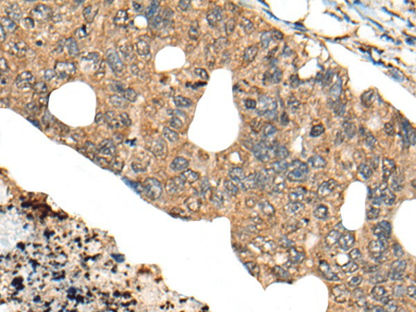 PPP3R1 Polyclonal Antibody (E-AB-52509)