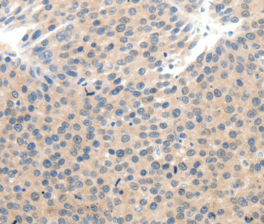 SCN10A Polyclonal Antibody (E-AB-12862)