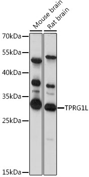 TPRG1L Polyclonal Antibody (E-AB-91367)