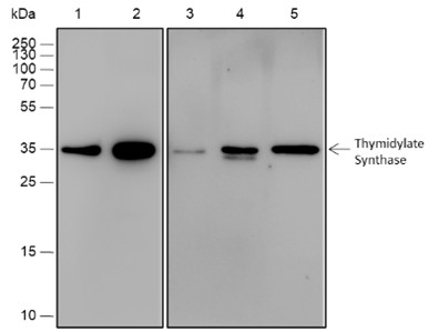 Recombinant Thymidylate Synthase Monoclonal Antibody (AN301812L)