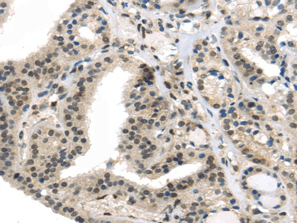 TUSC5 Polyclonal Antibody (E-AB-17490)