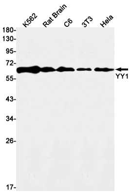Recombinant YY1 Monoclonal Antibody (E-AB-81623)