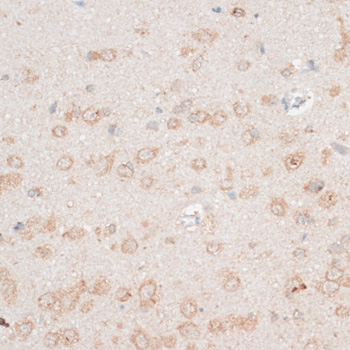 CDH18 Polyclonal Antibody (E-AB-66319)