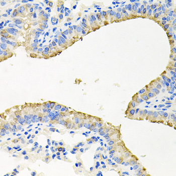 STRN3 Polyclonal Antibody (E-AB-61342)