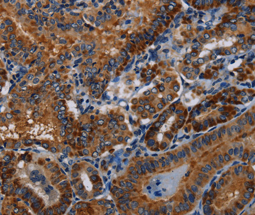 PIDD1 Polyclonal Antibody (E-AB-11369)