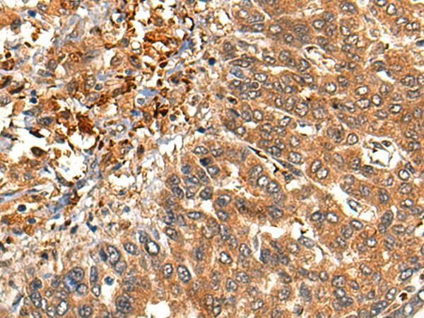MARK3 Polyclonal Antibody (E-AB-17852)