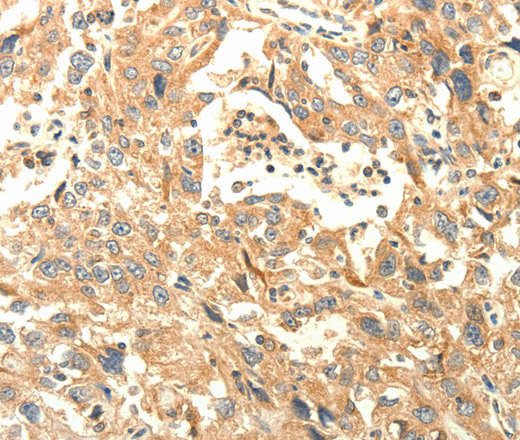 AGRN Polyclonal Antibody (E-AB-15907)