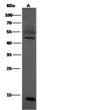 Leptin/LEP Monoclonal Antibody (AN200097P)