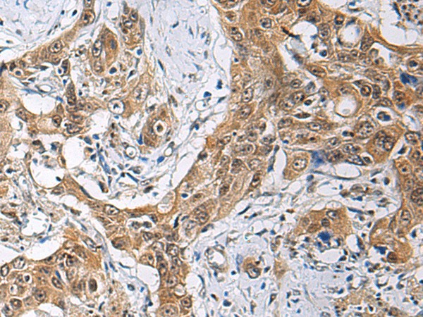 THOC3 Polyclonal Antibody (E-AB-19246)