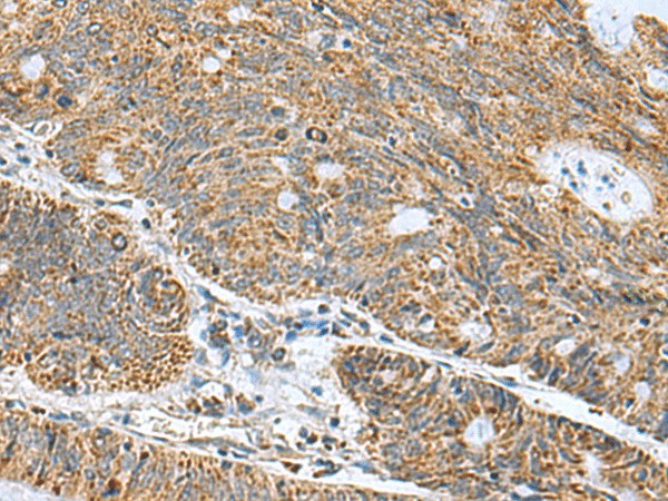 MRPL40 Polyclonal Antibody (E-AB-53084)