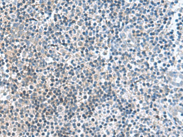 FAM107B Polyclonal Antibody (E-AB-53033)