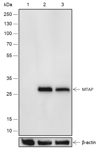 Recombinant MTAP Monoclonal Antibody (AN301807L)