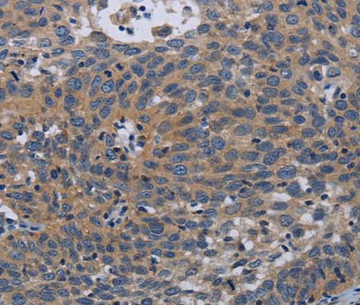 PAPPA Polyclonal Antibody (E-AB-16680)