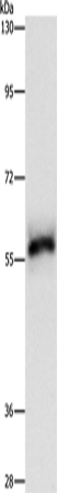 HCK Polyclonal Antibody (E-AB-14119)